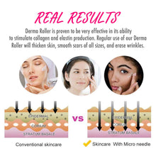 Load image into Gallery viewer, 1080 Derma Roller Body Roller - 6 Sizes