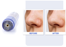Load image into Gallery viewer, Electric Blackhead Remover & Pore Cleanser