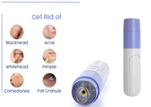 Load image into Gallery viewer, Electric Blackhead Remover & Pore Cleanser