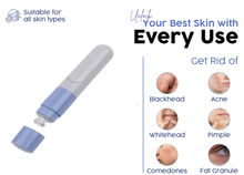 Load image into Gallery viewer, Electric Blackhead Remover & Pore Cleanser