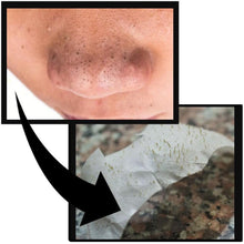 Load image into Gallery viewer, Glamza Deep Cleansing Sticky Nose Strips – Instantly Remove Blackheads & Unclog Pores - Free Postage