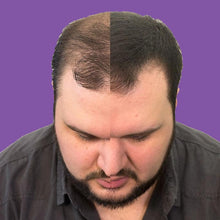 Load image into Gallery viewer, Volumon Hair Loss Building Fibres - COTTON 28g - For Men & Women!