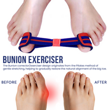Load image into Gallery viewer, Bunion Exerciser Strap – Free UK Delivery