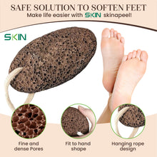Load image into Gallery viewer, Skinapeel Large Dead Skin Exfoliating Pumice Stone