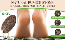 Load image into Gallery viewer, Skinapeel Large Dead Skin Exfoliating Pumice Stone