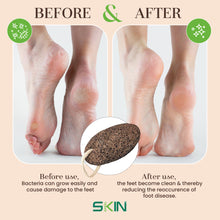 Load image into Gallery viewer, Skinapeel Large Dead Skin Exfoliating Pumice Stone