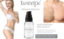 Load image into Gallery viewer, Tweepi Hair Growth Inhibitor Oil