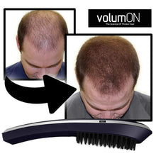 Load image into Gallery viewer, Volumon Laser Hair Massage Comb – Stimulate Hair Growth & Boost Scalp Health - FREE Postage Across the UK!