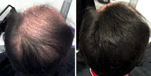 Load image into Gallery viewer, Volumon KERATIN Hair Loss Building Fibres Kit 12g or 28g with Fibre Hold Spray and Optimiser Comb