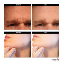 Load image into Gallery viewer, iB 540 Titanium Derma Roller With Optional Dermier Collagen Serum - See Options