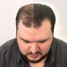 Load image into Gallery viewer, Volumon KERATIN Hair Loss Building Fibres Kit 12g or 28g with Fibre Hold Spray and Optimiser Comb