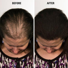 Load image into Gallery viewer, Volumon KERATIN Hair Loss Building Fibres Kit 12g or 28g with Fibre Hold Spray and Optimiser Comb