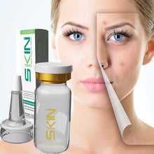 Load image into Gallery viewer, Skinapeel Skincare Serum Collection – 10ml - 12 Targeted Skincare Solutions