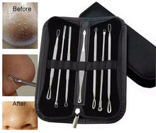 Load image into Gallery viewer, Blackhead & Spot Removal Tool Kits – Professional-Grade Skincare Solutions