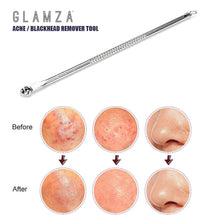 Load image into Gallery viewer, Glamza Double-Ended Spot Removal Tool – Precision Blackhead & Pimple Extractor