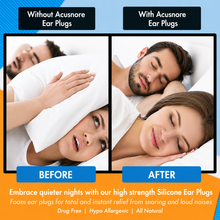 Load image into Gallery viewer, The Acusnore Soft Silicone Ear Plugs for Better Sleep - 6 Pack