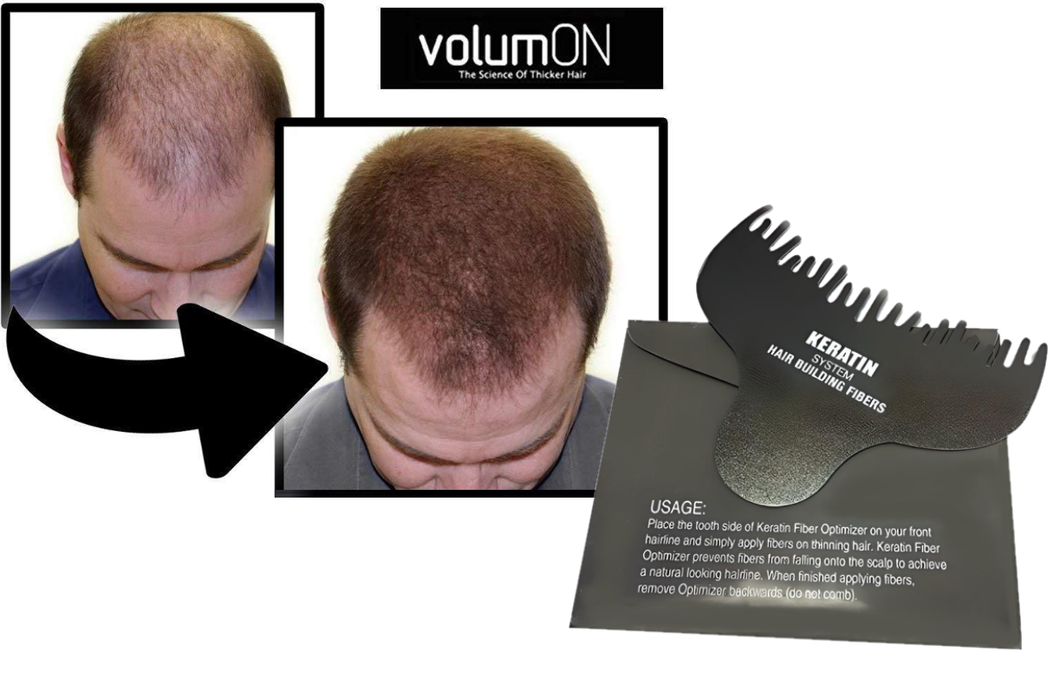 Hair Loss Fibres Hairline Optimiser Template – Free UK Delivery