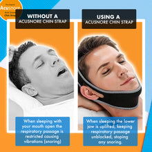 Load image into Gallery viewer, Acusnore Anti Snore Chin Strap