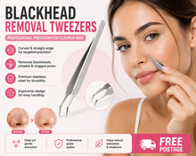 Load image into Gallery viewer, Glamza Blackhead Removal Straight Tweezer – Professional Precision for Clearer Skin - FREE POSTAGE