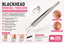 Load image into Gallery viewer, Glamza Blackhead Removal Straight Tweezer – Professional Precision for Clearer Skin - FREE POSTAGE