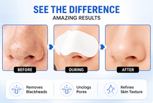 Load image into Gallery viewer, Glamza Deep Cleansing Sticky Nose Strips – Instantly Remove Blackheads &amp; Unclog Pores