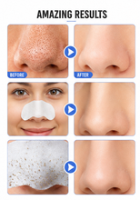 Load image into Gallery viewer, Glamza Deep Cleansing Sticky Nose Strips – Instantly Remove Blackheads &amp; Unclog Pores