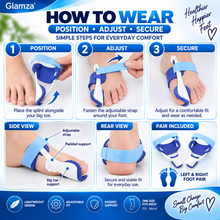 Load image into Gallery viewer, Glamza Splint Corrector Device Pair – Free UK Delivery