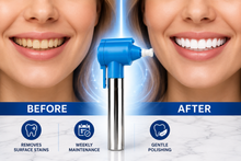 Load image into Gallery viewer, Luma Smile Teeth Whitening &amp; Polishing Gun – At-Home Stain Removal with Free UK Delivery