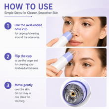 Load image into Gallery viewer, Electric Blackhead Remover &amp; Pore Cleanser