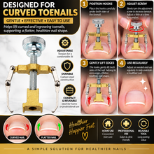 Load image into Gallery viewer, Ingrown Toenail Corrector Clamp – Professional Relief &amp; Nail Reshaping Tool