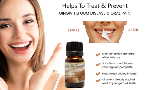 Herbal Dentist Tooth and Gum Oil 15ml – Natural Oral Pain Relief & Gum Health Booster