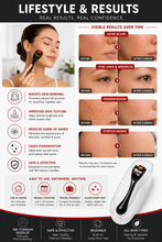 Load image into Gallery viewer, MT Titanium Derma Roller Collection 180 Needle