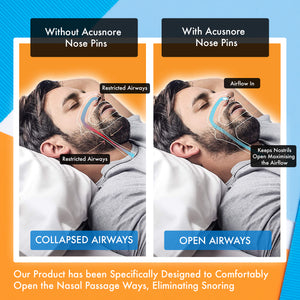 Acusnore Air Flow Nose Pins - Stop Snoring &amp; Breathe Better | Free UK Delivery