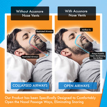 Load image into Gallery viewer, Acusnore Air Flow Nose Vents - Stop Snoring &amp; Breathe Better | Free UK Delivery