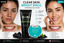 Load image into Gallery viewer, Skinapeel Deep Cleansing Black Face Mask &amp; Rise and Shine Activated Charcoal Teeth Whitening Powder – Free UK Postage