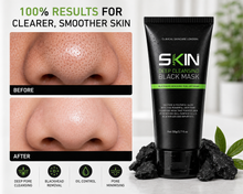 Load image into Gallery viewer, Skinapeel Blackhead Removing Deep Cleansing Peel-Off Mask – 100% Results for Clearer Skin