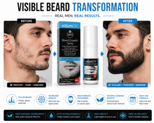 Load image into Gallery viewer, Volumon Beard Growth Spray – 60ml, 120ml, or 180ml – Fuller, Thicker Beard Fast – Free UK Delivery