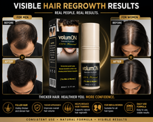 Load image into Gallery viewer, Volumon Hair Regrowth Solution Spray 60ml