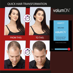 Volumon Unisex Hair Loss Concealer Refill Packs – 22g (Single or Double Pack) – Free UK Delivery