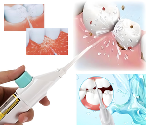 Glamza Jet Power Dental Floss – Cordless Water Jet Flosser