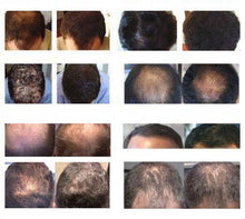 Load image into Gallery viewer, Volumon Hair Regrowth Solution Spray 60ml