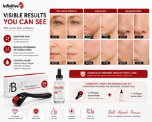 Load image into Gallery viewer, Infinitive Beauty 2 Piece Microneedling Kit | Titanium Derma Roller + Collagen Serum | Professional At-Home Skincare | Free UK Delivery
