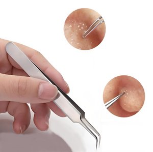 Glamza Blackhead Removal Straight Tweezer – Professional Precision for Clearer Skin - FREE POSTAGE
