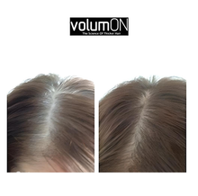 Load image into Gallery viewer, Volumon Hair Loss Concealer and Root Cover Up Kit