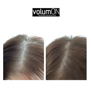 Volumon Hair Loss Concealer and Root Cover Up Kit