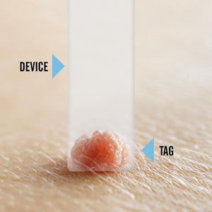 Tagcure PLUS Skin Tag Removal Device & 10 or 20 Pack Extra Mini Bands PLUS - For Skin Tags 0.5cm or Larger - Unisex