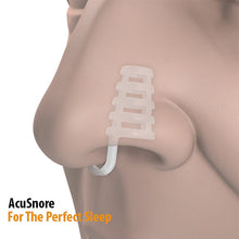 Load image into Gallery viewer, Acusnore Air Flow Nose Vents for Snoring and Better Breathing