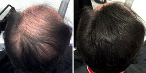Volumon Hair Loss Building Fibres - COTTON 12g