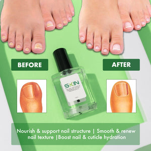 Skinapeel Toenail Softener & Ingrowing Toenail Prevention Oil – Free UK Delivery