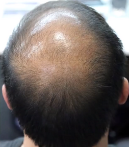 Volumon Hair Loss Building Fibres - COTTON 28g - For Men & Women!
